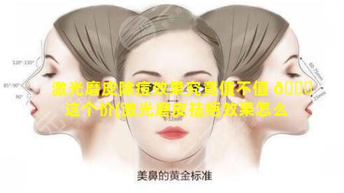 激光磨皮除痘效果究竟值不值 🐘 这个价(激光磨皮祛疤效果怎么样)